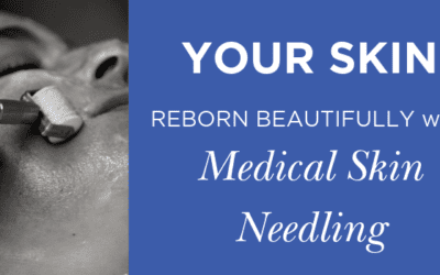 Your Skin Reborn BEAUTIFULLY with Medical Skin Needling